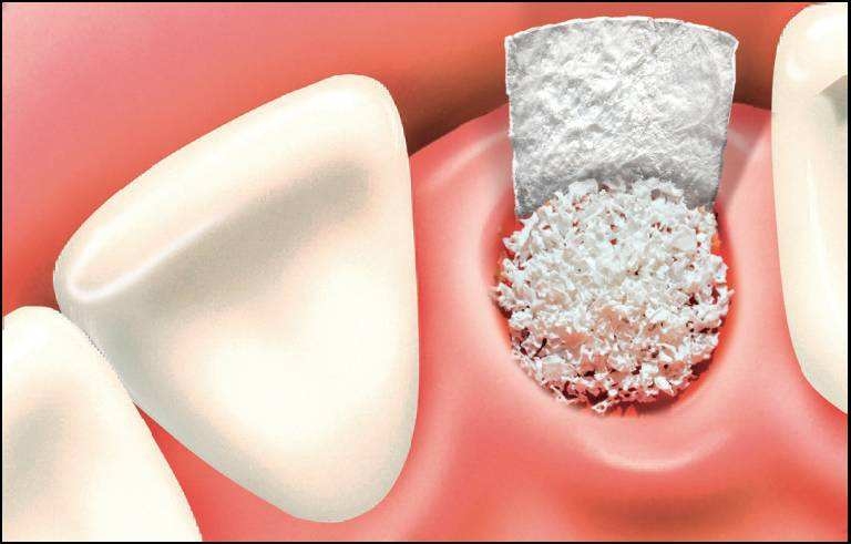 Membrana de colágeno sem sabor de peptídeos hidrolisados ​​avançados